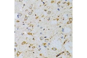 Immunohistochemistry of paraffin-embedded mouse brain using SRP19 antibody (ABIN6129677, ABIN6148450, ABIN6148451 and ABIN6222484) at dilution of 1:100 (40x lens).