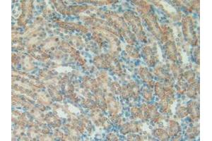 Detection of SFTPA1 in Rat Kidney Tissue using Polyclonal Antibody to Pulmonary Surfactant Associated Protein A1 (SFTPA1)