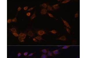 Immunofluorescence analysis of NIH-3T3 cells using POR Polyclonal Antibody at dilution of 1:100 (40x lens). (POR anticorps)