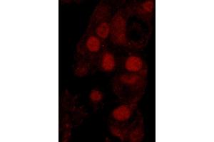 Immunofluorescence (IF) image for anti-Werner Helicase Interacting Protein 1 (WRNIP1) (AA 400-450) antibody (ABIN7449035)