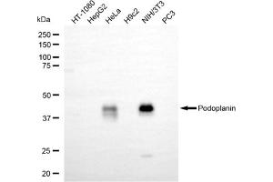 anti-Podoplanin (PDPN) antibody