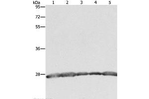 Western Blot analysis of Hela, 293T and MCF7 cell, Human fetal brain tissue and Jurkat cell using PRDX3 Polyclonal Antibody at dilution of 1:800 (Peroxiredoxin 3 anticorps)