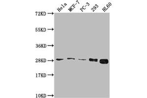 Western Blot Positive WB detected in: Hela whole cell lysate, MCF-7 whole cell lysate, PC-3 whole cell lysate, 293 whole cell lysate, HL60 whole cell lysate All lanes: RPL19 antibody at 1:2000 Secondary Goat polyclonal to rabbit IgG at 1/50000 dilution Predicted band size: 24 kDa Observed band size: 28 kDa (RPL19 anticorps  (AA 79-196))