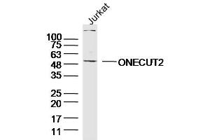Jurkay lysates probed with ONECUT2 Polyclonal Antibody, Unconjugated  at 1:300 overnight at 4˚C. (ONECUT2 anticorps  (AA 401-504))