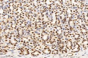 Immunohistochemistry analysis of paraffin-embedded rat stomach using,SET (ABIN7075583) at dilution of 1: 10000