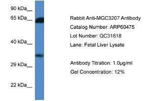 Western Blotting (WB) image for anti-Methylthioribose-1-Phosphate Isomerase 1 (Mri1) (N-Term) antibody (ABIN2788459) (MRI1 anticorps  (N-Term))