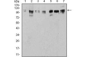 Western Blotting (WB) image for anti-Unc-51 Like Kinase 2 (ULK2) (AA 1-155) antibody (ABIN5882566) (ULK2 anticorps  (AA 1-155))