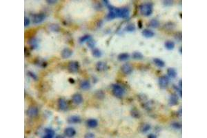 IHC-P analysis of Kidney tissue, with DAB staining. (LDHB anticorps  (AA 1-334))