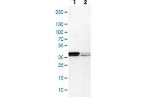 Western blot analysis of Lane 1: NIH-3T3 cell lysate (Mouse embryonic fibroblast cells), Lane 2: NBT-II cell lysate (Rat Wistar bladder tumour cells) with HNRNPA2B1 polyclonal antibody . (HNRNPA2B1 anticorps)