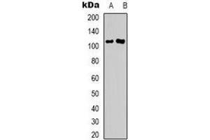 Western blot analysis of GKAP expression in MDAMB231 (A), HEK293T (B) whole cell lysates. (DLGAP1 anticorps  (C-Term))