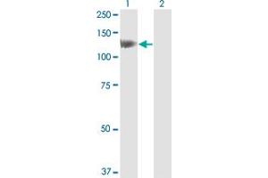 Western Blot analysis of HIP1 expression in transfected 293T cell line by HIP1 monoclonal antibody (M01), clone 1F12.
