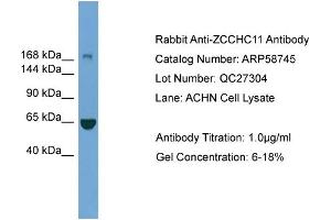 WB Suggested Anti-ZCCHC11  Antibody Titration: 0. (ZCCHC11 anticorps  (Middle Region))