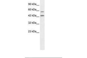 Image no. 2 for anti-Autophagy related 4B Cysteine Peptidase (ATG4B) (C-Term) antibody (ABIN6735868) (ATG4B anticorps  (C-Term))