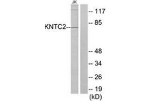 Western blot analysis of extracts from Jurkat cells, using KNTC2 Antibody. (NDC80 anticorps  (AA 351-400))