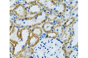Immunohistochemistry of paraffin-embedded Mouse kidney using GDAP1 Polyclonal Antibody at dilution of 1:100 (40x lens). (GDAP1 anticorps)