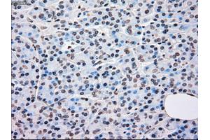 Immunohistochemical staining of paraffin-embedded Kidney tissue using anti-BRAFmouse monoclonal antibody. (BRAF anticorps)