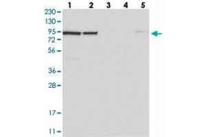 Western blot analysis of Lane 1: RT-4, Lane 2: U-251 MG, Lane 3: Human Plasma, Lane 4: Liver, Lane 5: Tonsil with UFL1 polyclonal antibody  at 1:250-1:500 dilution. (UFL1 anticorps)