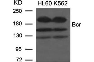 Western blot analysis of extracts from HL60 and K562 cells using Bcr(Ab-177) Antibody.