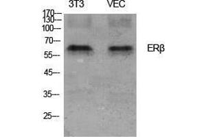 Western Blot (WB) analysis of specific cells using ERbeta Polyclonal Antibody. (ESR2 anticorps  (Ser367))