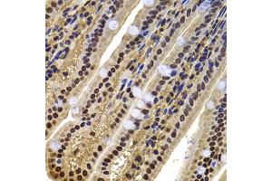 Immunohistochemistry of paraffin-embedded mouse jejunum using ACTL6B antibody (ABIN5974275) at dilution of 1/100 (40x lens).