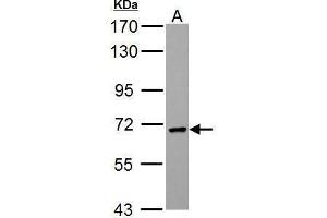 WB Image PCK2 antibody [C1C2], Internal detects PCK2 protein by Western blot analysis. (PEPCK anticorps)