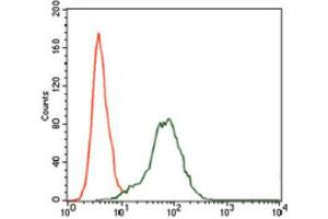 Immunohistochemical analysis of paraffin-embedded bladder cancer tissues using Insulin Like Growth Factor 2 (IGF2) antibody with DAB staining. (IGF2 anticorps  (AA 25-180))