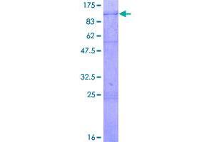 Image no. 1 for DEAD (Asp-Glu-Ala-Asp) Box Polypeptide 3, X-Linked (DDX3X) (AA 1-662) protein (GST tag) (ABIN1351345)