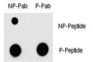 Dot blot analysis of phospho-MEF2C antibody and nonphos MEF2C Ab.