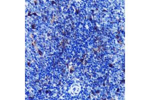 Immunohistochemistry of paraffin-embedded rat spleen using S100B Rabbit mAb (ABIN7270131) at dilution of 1:100 (40x lens).