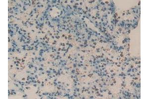 Detection of REG3g in Rat Lung Tissue using Polyclonal Antibody to Regenerating Islet Derived Protein 3 Gamma (REG3g) (REG3g anticorps  (AA 33-147))