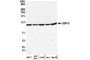Western Blotting (WB) image for anti-Ubiquitin Specific Peptidase 10 (USP10) (AA 50-100) antibody (ABIN7453890) (USP10 anticorps  (AA 50-100))