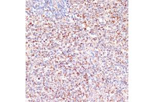 Immunohistochemistry of paraffin-embedded human lymph node using MRPL46 antibody (ABIN7268574) at dilution of 1:100 (40x lens).