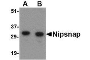Image no. 1 for anti-4-Nitrophenylphosphatase Domain and Non-Neuronal SNAP25-Like Protein Homolog 1 (NIPSNAP1) (Internal Region) antibody (ABIN1493790) (NIPSNAP1 anticorps  (Internal Region))