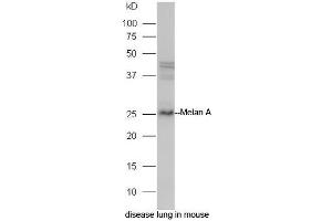 Mouse lung lysate probed with Rabbit Anti-Melan A Polyclonal Antibody, Unconjugated (ABIN2559583) at 1:300 in 4˚C. (MLANA anticorps  (AA 1-80))