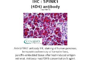 Image no. 1 for anti-serine Peptidase Inhibitor, Kazal Type 1 (SPINK1) (AA 24-80) antibody (ABIN1723764)
