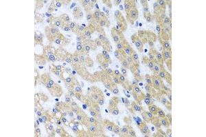 Immunohistochemistry of paraffin-embedded human liver injury using PRMT2 antibody (ABIN5973447) at dilution of 1/100 (40x lens). (PRMT2 anticorps)