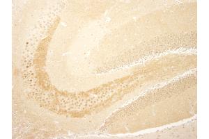 Immunohistochemistry (IHC) image for anti-CREB Regulated Transcription Coactivator 1 (CRTC1) (C-Term) antibody (ABIN7448839)