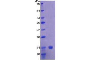 SDS-PAGE analysis of Human CAP1 Protein.