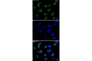Histone H3 trimethyl Lys9 antibody tested by immunofluorescence. (Histone 3 anticorps  (3meLys9))