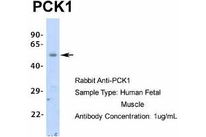Host: Rabbit  Target Name: PCK1  Sample Tissue: Human Fetal Muscle  Antibody Dilution: 1.