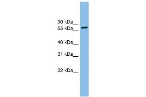 WB Suggested Anti-ODF2 Antibody Titration: 0. (ODF2 anticorps  (N-Term))