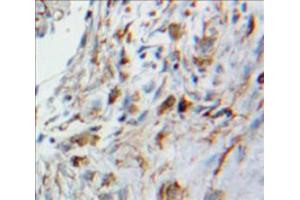 Used in DAB staining on fromalin fixed paraffin-embedded Lung tissue