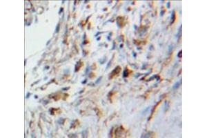 Used in DAB staining on fromalin fixed paraffin-embedded Lung tissue (HMOX2 anticorps  (AA 41-292))