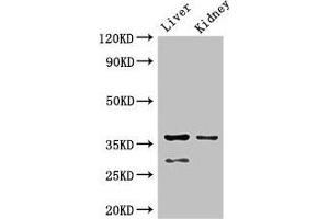 Western Blot Positive WB detected in: Mouse liver tissue, Mouse kidney tissue All lanes: PPP2CA antibody at 2. (PPP2CA anticorps  (Catalytic Subunit alpha))