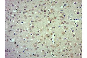 Paraformaldehyde-fixed, paraffin embedded mouse brain; Antigen retrieval by boiling in sodium citrate buffer (pH6.
