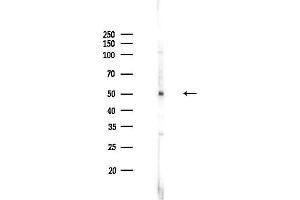 Western blot analysis of lysates from HepG2 cells(LPS,4h treatment), using BMPR1B Antibody at 1/1000 dilution.