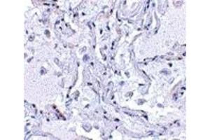 Immunohistochemistry (IHC) image for anti-Transition Protein 1 (During Histone To Protamine Replacement) (TNP1) (N-Term) antibody (ABIN1031638)
