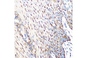 Immunohistochemistry of paraffin-embedded human esophageal using OSR1 Rabbit pAb (ABIN7269080) at dilution of 1:100 (40x lens).