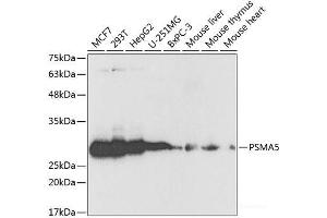 Western blot analysis of extracts of various cell lines using PSMA5 Polyclonal Antibody at dilution of 1:1000. (PSMA5 anticorps)