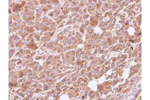 IHC-P Image Immunohistochemical analysis of paraffin-embedded SAS xenograft, using G protein alpha Inhibitor 3, antibody at 1:500 dilution. (G Protein alpha Inhibitor 3 (Center) anticorps)